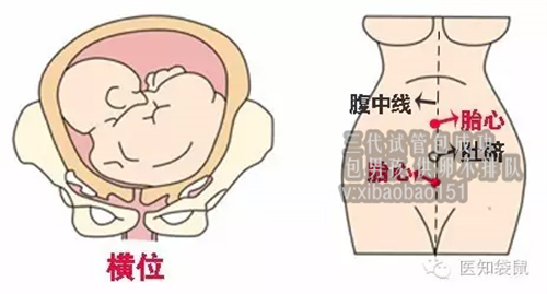 【大连代怀中介电话】，中国第一个“试管婴儿”，现在已经32岁了，让很多人